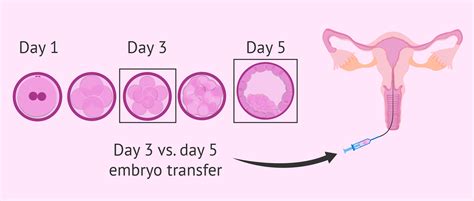 Embryotransfer